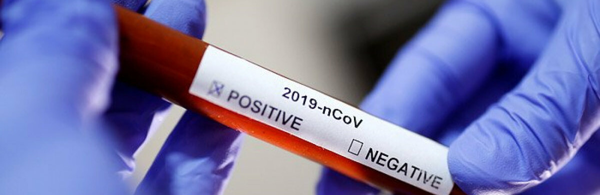  ������� ������������� ���������� ���������� covid-19 ����� 