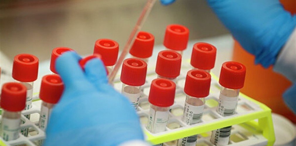  ���������������� �������� ���������� ���������� covid-19 