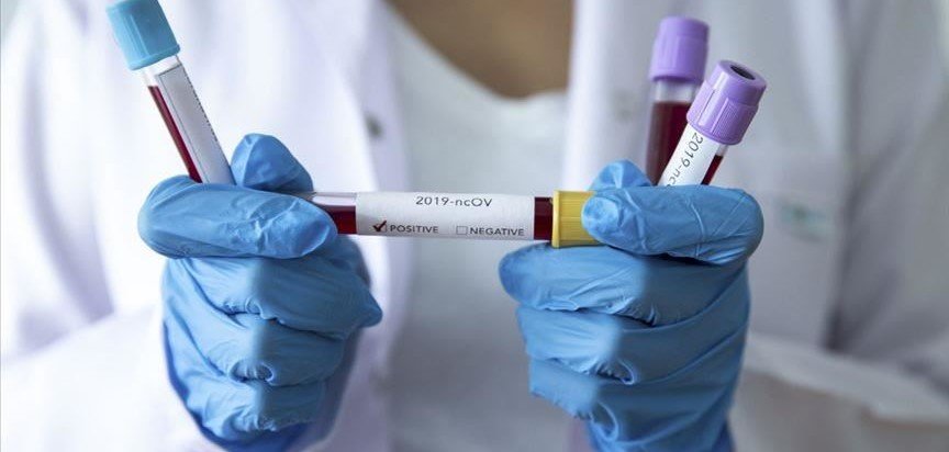  ���������������� ������ �������� ��������� covid-19 