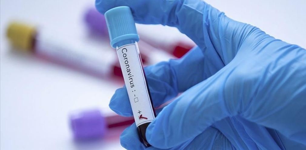  ��������� ���������� ������ covid-19 