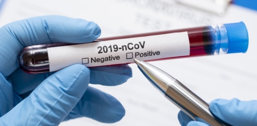  ��������� ���������� ����� ������ covid-19 