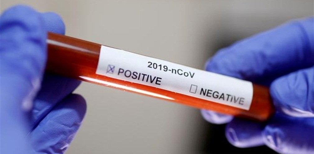  ��������� ������� ������ covid-19 