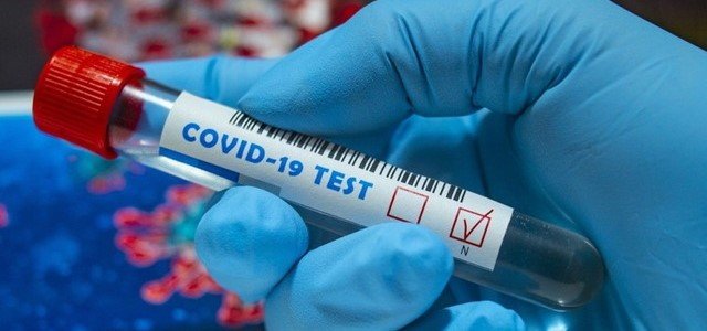  ��������� ���������� covid-19 