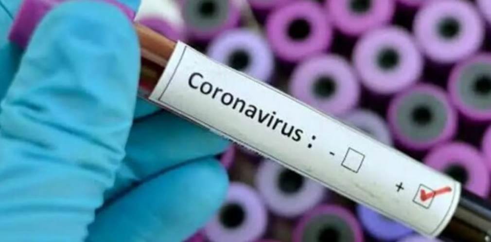  ��������� ������� ������� covid-19 