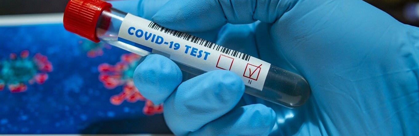 Викликає нежить і свербіння очей: світом шириться новий штам Covid-19