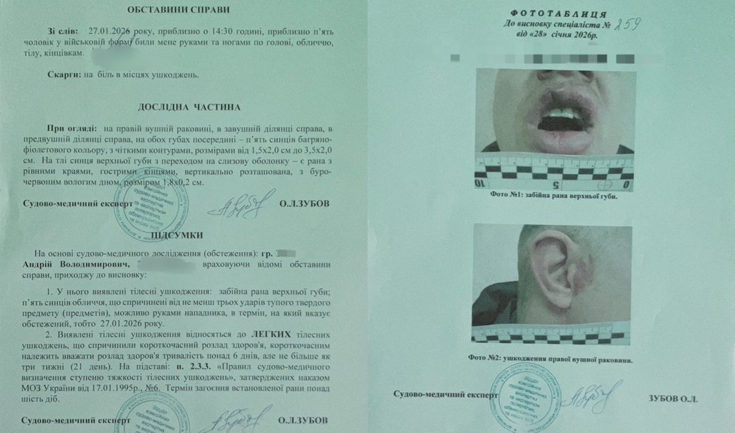 Висновок судово-медичної експертизи.