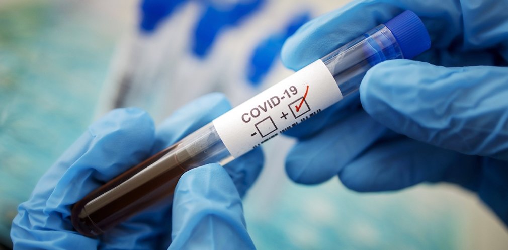 На Днепропетровщине на COVID-19 проверили более 8,5 тысяч человек На Днепропетровщине на COVID-19 проверили более 8,5 тысяч человек, Анжелика Кудряшкина